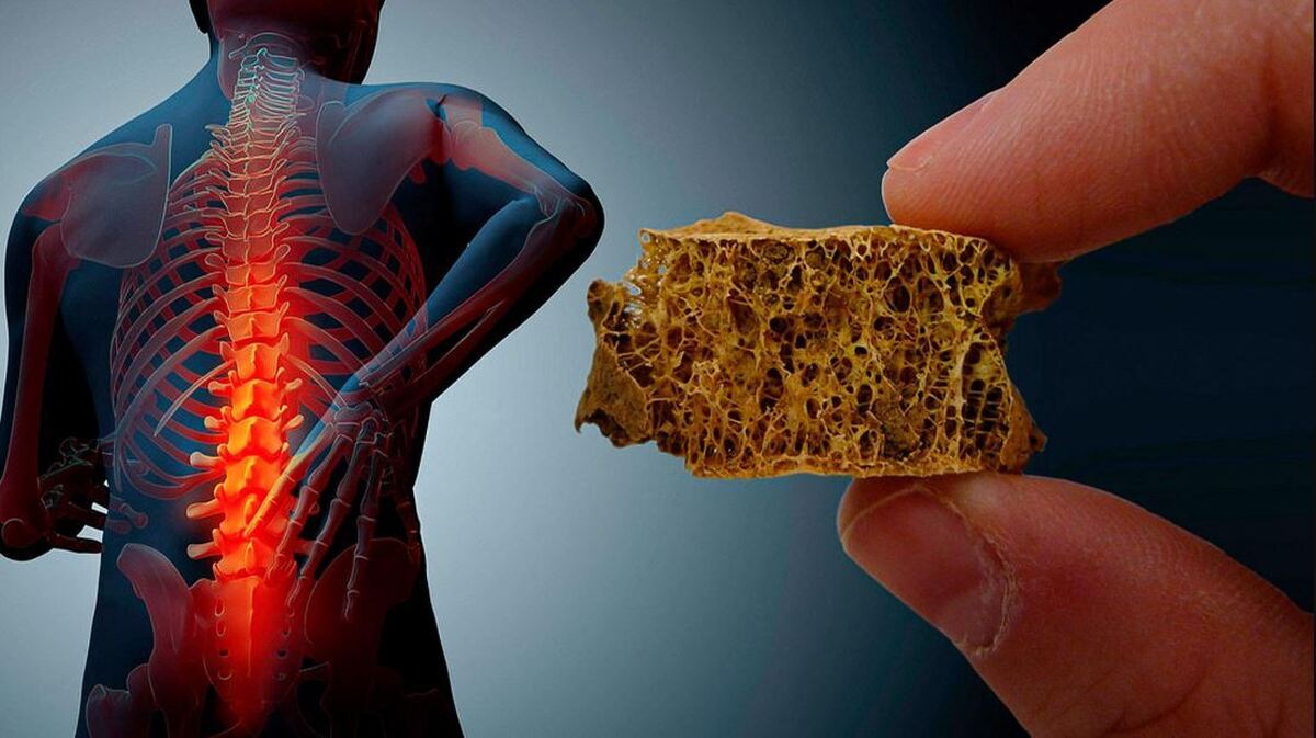 جلوگیری از پوکی استخوان با این خوردنی‌ها